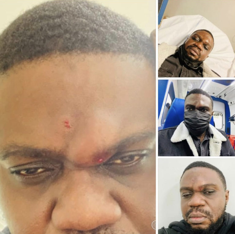 L'artiste Aimé Nkanu victime d'agression