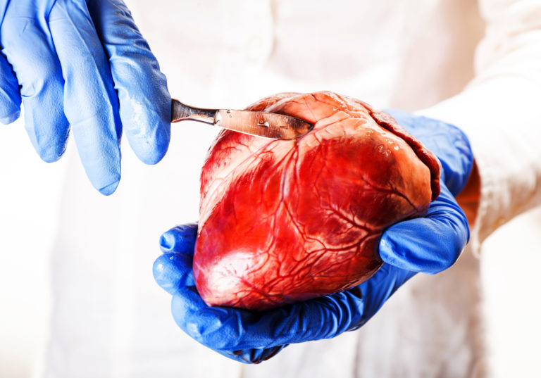 Cœur dans la main d'un chirurgien avec un scalpel dans l'autre main