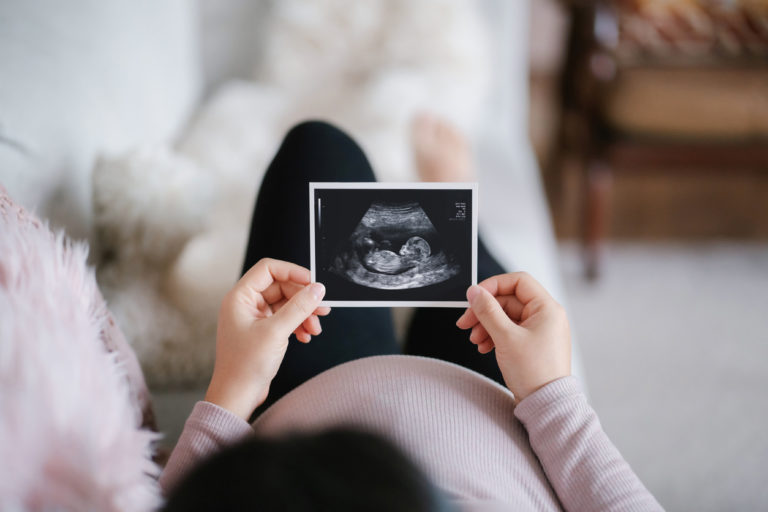 Une femme enceinte regarde la photo de son échographie, allongée sur son canapé