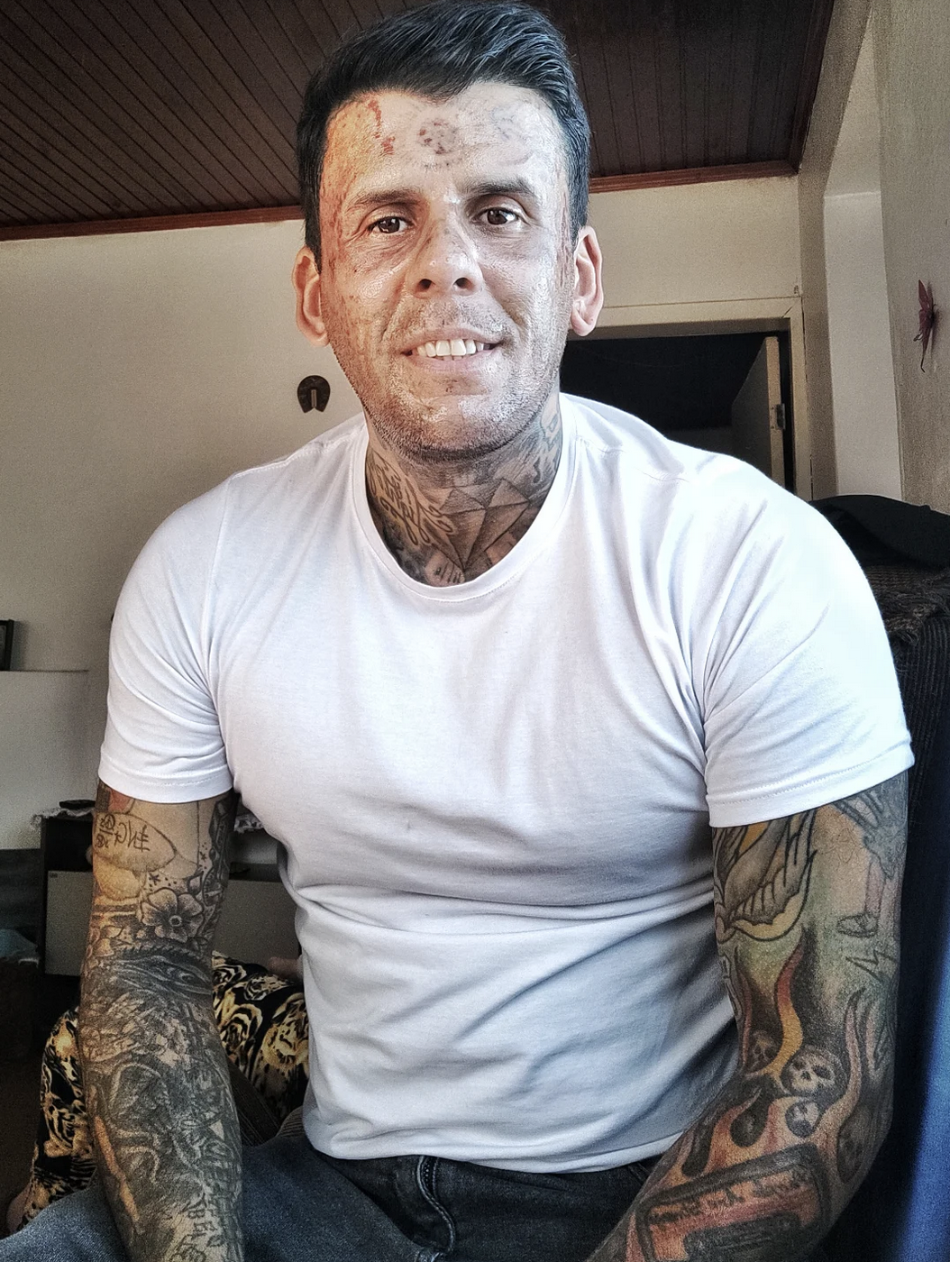 Portrait de Leandro de Souza, ancien homme le plus tatoué du Brésil, après avoir effacé ses tatouages